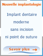 Professionnelle de l'implantologie dentaire en Tunisie, Implant Dentaire Tunisie vous fournit la chirugie des implants dentaires la plus moderne sans incision ni point de suture